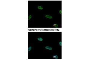 ICC/IF Image Immunofluorescence analysis of paraformaldehyde-fixed HeLa, using TRIP15, antibody at 1:500 dilution. (COPS2 antibody  (C-Term))