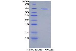 SDS-PAGE (SDS) image for Gap Junction Protein, beta 3, 31kDa (GJB3) (AA 84-174) protein (His tag,GST tag) (ABIN2122700)