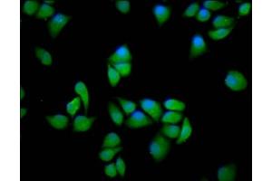 Immunofluorescence staining of Hela cells with ABIN7169254 at 1:166, counter-stained with DAPI. (PPP2R5E antibody  (Regulatory Subunit))