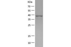 NCK1 Protein (AA 1-377) (His tag)