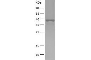 Western Blotting (WB) image for NCK Adaptor Protein 1 (NCK1) (AA 1-377) protein (His tag) (ABIN7124117) (NCK1 Protein (AA 1-377) (His tag))