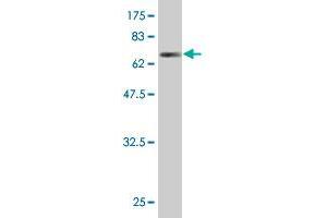 Western Blot detection against Immunogen (67. (GPD2 antibody  (AA 1-378))