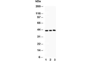Western blot testing of SIRT2 antibody and Lane 1:  rat spleen;  2: HeLa;  3: A549 (SIRT2 antibody  (AA 165-187))