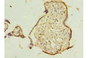 Immunohistochemistry of paraffin-embedded human placenta tissue using ABIN7173035 at dilution of 1:100 (TMEM115 antibody  (AA 187-351))