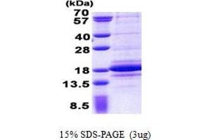 SDS-PAGE (SDS) image for C1D Nuclear Receptor Corepressor (C1D) (AA 1-141) protein (His tag) (ABIN5853022) (C1D Protein (AA 1-141) (His tag))