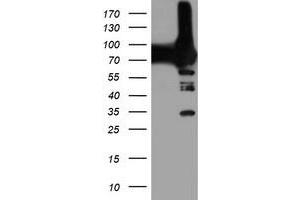 Western Blotting (WB) image for anti-phosphofructokinase, Platelet (PFKP) antibody (ABIN1500166)