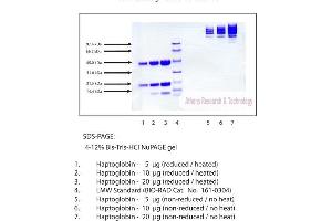 Gel Scan of Haptoglobin, Human Plasma, Mixed Type  This information is representative of the product ART prepares, but is not lot specific. (Haptoglobin Protein (HP))