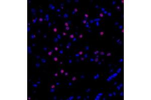 Immunofluorescent analysis of paraffin embedded mouse hippocampus using ZFPM2 (ABIN7076277) at dilution of 1: 300 (ZFPM2 antibody)