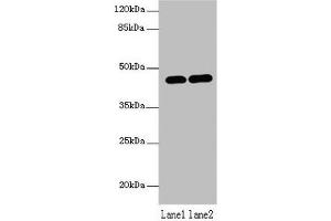 Western blot All lanes: LMNTD1 antibody at 12 μg/mL Lane 1: MCF-7 whole cell lysate Lane 2: Mouse liver tissue Secondary Goat polyclonal to rabbit IgG at 1/10000 dilution Predicted band size: 44, 34, 37, 42, 46 kDa Observed band size: 44 kDa (PAS1C1 antibody  (AA 113-291))
