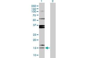 Western Blot analysis of SPINK1 expression in transfected 293T cell line by SPINK1 MaxPab polyclonal antibody.