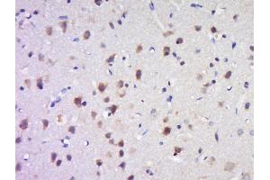 Paraformaldehyde-fixed, paraffin embedded rat brain tissue, Antigen retrieval by boiling in sodium citrate buffer(pH6) for 15min, Block endogenous peroxidase by 3% hydrogen peroxide for 30 minutes, Blocking buffer (normal goat serum) at 37°C for 20min, Antibody incubation with Rabbit Anti-SAPAP4 Polyclonal Antibody, Unconjugated  at 1:500 overnight at 4°C, followed by a conjugated secondary and DAB staining (DLGAP4 antibody  (AA 261-370))