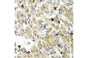 Immunohistochemistry of paraffin-embedded human stomach using MMP9 antibody (ABIN5971121) at dilution of 1/100 (40x lens). (MMP 9 antibody)