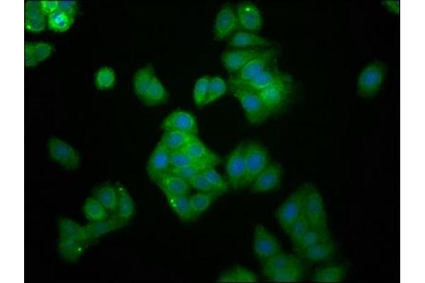 UBE2G1 antibody  (AA 2-170)