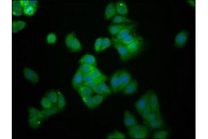 Immunofluorescence staining of HepG2 cells with ABIN7174451 at 1:166, counter-stained with DAPI. (UBE2G1 antibody  (AA 2-170))