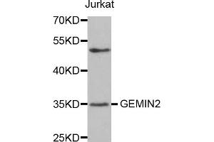 Western blot analysis of extracts of Jurkat cells, using GEMIN2 antibody. (SIP1 antibody)