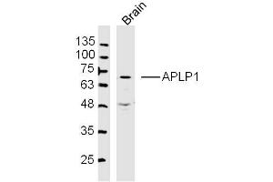 Mouse Brain lysates probed with APLP1 Polyclonal Antibody, Unconjugated  at 1:300 dilution and 4˚C overnight incubation. (APLP1 antibody  (AA 1-100))