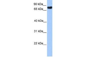 WB Suggested Anti-TLE2 Antibody Titration:  0.