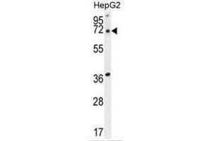 ACOT11 Antibody (C-term) western blot analysis in HepG2 cell line lysates (35 µg/lane). (ACOT11 antibody  (C-Term))