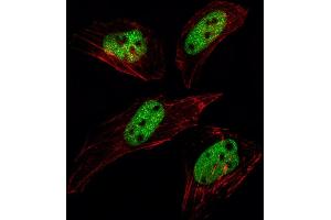 Fluorescent image of Hela cell stained with SUMO1 Antibody (N-term E67) (ABIN1882137 and ABIN2845494)/SH030609A. (SUMO1 antibody  (N-Term))