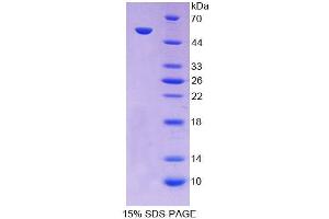 SDS-PAGE (SDS) image for Pyruvate Carboxylase (PC) (AA 36-486) protein (His tag) (ABIN6237552)