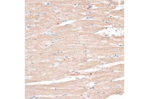 Immunohistochemistry of paraffin-embedded rat heart using ABCB7 antibody. (ABCB7 antibody)