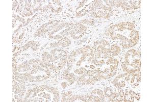Immunohistochemistry (IHC) image for anti-Histone H3 (H3) (C-Term) antibody (ABIN7455227) (Histone 3 antibody  (C-Term))