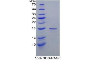SDS-PAGE (SDS) image for Retinol Binding Protein 1, Cellular (RBP1) (AA 2-135) protein (His tag) (ABIN2122005) (RBP1 Protein (AA 2-135) (His tag))