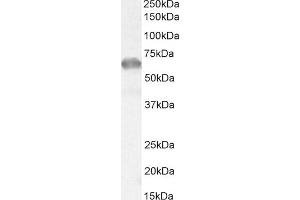 (ABIN308416) (0. (IRAK3 antibody  (Internal Region))