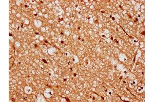 IHC image of ABIN7168370 diluted at 1:300 and staining in paraffin-embedded human brain tissue performed on a Leica BondTM system. (MEX3A antibody  (AA 416-466))