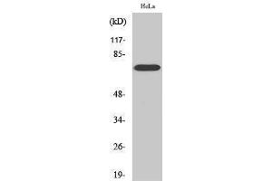 Western Blotting (WB) image for anti-V-Raf-1 Murine Leukemia Viral Oncogene Homolog 1 (RAF1) (Thr56) antibody (ABIN3186667) (RAF1 antibody  (Thr56))