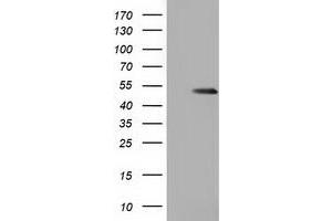 HEK293T cells were transfected with the pCMV6-ENTRY control (Left lane) or pCMV6-ENTRY GSS (Right lane) cDNA for 48 hrs and lysed. (Glutathione Synthetase antibody)