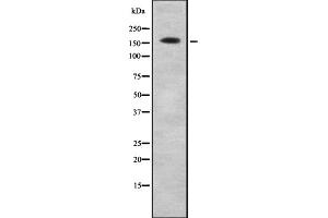 Western blot analysis of COL4A6 using K562 whole cell lysates