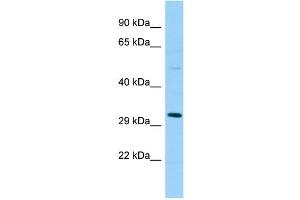 WB Suggested Anti-SPSB1 Antibody Titration: 1. (SPSB1 antibody  (Middle Region))