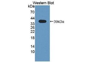 Detection of Recombinant RIPK2, Mouse using Polyclonal Antibody to Receptor Interacting Serine Threonine Kinase 2 (RIPK2) (RIPK2 antibody  (AA 1-294))