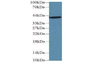 Western Blotting (WB) image for Glutamic-Oxaloacetic Transaminase 1, Soluble (Aspartate Aminotransferase 1) (GOT1) ELISA Kit (ABIN6574261)