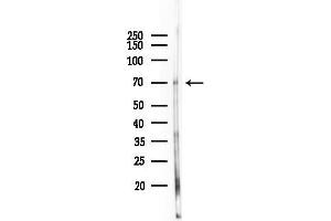 Western blot analysis of lysates from Rat liver, using SOX9 Antibody at 1/1000 dilution.