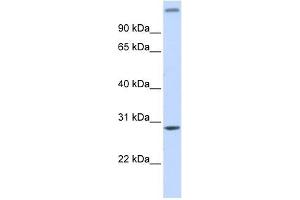 ALKBH2 antibody used at 1 ug/ml to detect target protein. (ALKBH2 antibody)