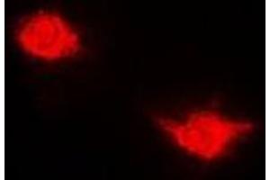 Immunofluorescent analysis of USP7 staining in Hela cells. (USP7 antibody)