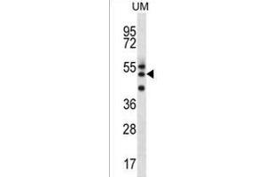 RMD2 Antibody (Center) (ABIN1538003 and ABIN2849325) western blot analysis in uterus tumor cell line lysates (35 μg/lane). (FAM82A1 antibody  (AA 188-216))