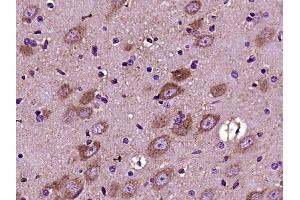 Paraformaldehyde-fixed, paraffin embedded rat brain, Antigen retrieval by boiling in sodium citrate buffer (pH6) for 15min, Block endogenous peroxidase by 3% hydrogen peroxide for 30 minutes, Blocking buffer (normal goat serum) at 37°C for 20min, Antibody incubation with Versican Polyclonal Antibody (bs-2533R) at 1:400 overnight at 4°C, followed by a conjugated secondary and DAB staining (Versican antibody  (AA 3301-3396))