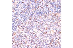 Immunohistochemistry of paraffin-embedded human tonsil using VHL antibody (ABIN3020967, ABIN3020968, ABIN3020969 and ABIN6213828) at dilution of 1:200 (40x lens). (VHL antibody  (AA 1-172))