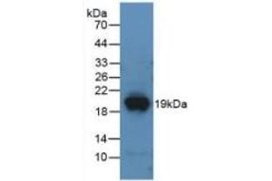 Western Blotting (WB) image for Dipeptidyl-Peptidase 4 (DPP4) ELISA Kit (ABIN6574232)
