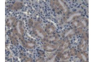IHC-P analysis of Mouse Kidney Tissue, with DAB staining. (CES1 antibody  (AA 31-286))
