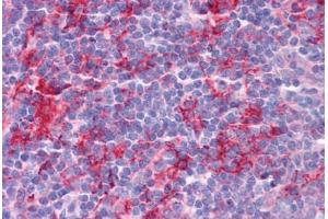 Human Tonsil: Formalin-Fixed, Paraffin-Embedded (FFPE) (KLHL25 antibody  (Internal Region))