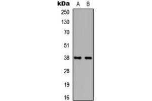 Western blot analysis of TBP expression in HEK293T (A), NIH3T3 (B) whole cell lysates. (TBP antibody  (Center))