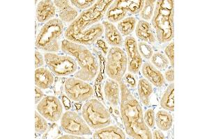 Immunohistochemistry of paraffin-embedded rat kidney using SLC12 Rabbit pAb (ABIN6131136, ABIN6147843, ABIN6147844 and ABIN6215366) at dilution of 1:50 (40x lens). (SLC12A2 antibody  (AA 120-280))
