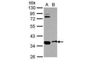 Image no. 1 for anti-Osteopetrosis Associated Transmembrane Protein 1 (OSTM1) (AA 1-334) antibody (ABIN1499928) (OSTM1 antibody  (AA 1-334))