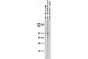 Adult rat brain membrane immunoblot.