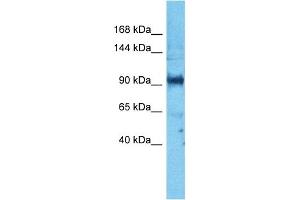 Host:  Rabbit  Target Name:  PARD3  Sample Type:  PANC1 Whole Cell lysates  Antibody Dilution:  1.