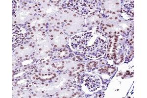 ABIN6267291 at 1/200 staining human kidney tissue sections by IHC-P. (p53 antibody  (pSer9))